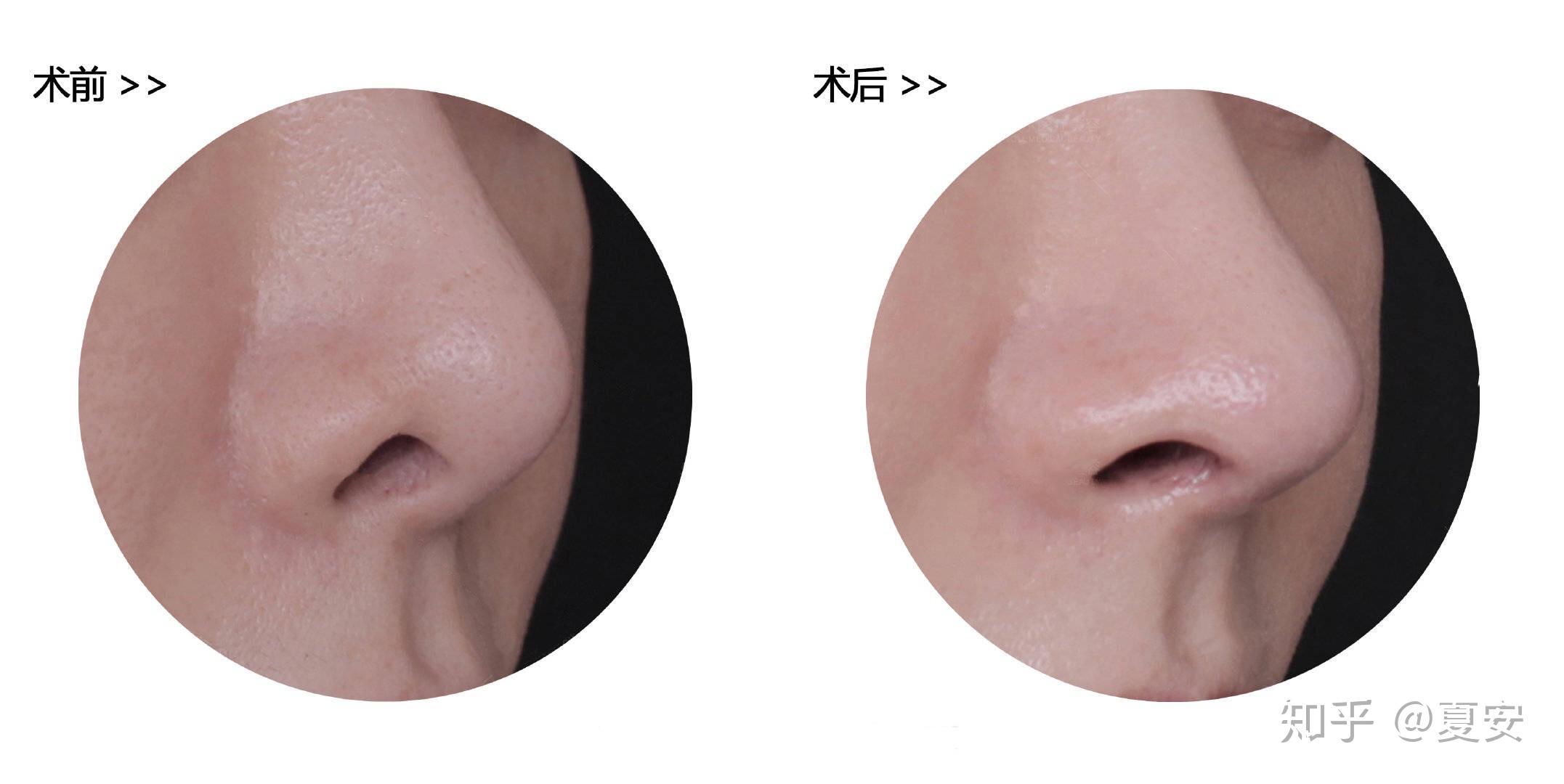 国内鼻修复医生测评