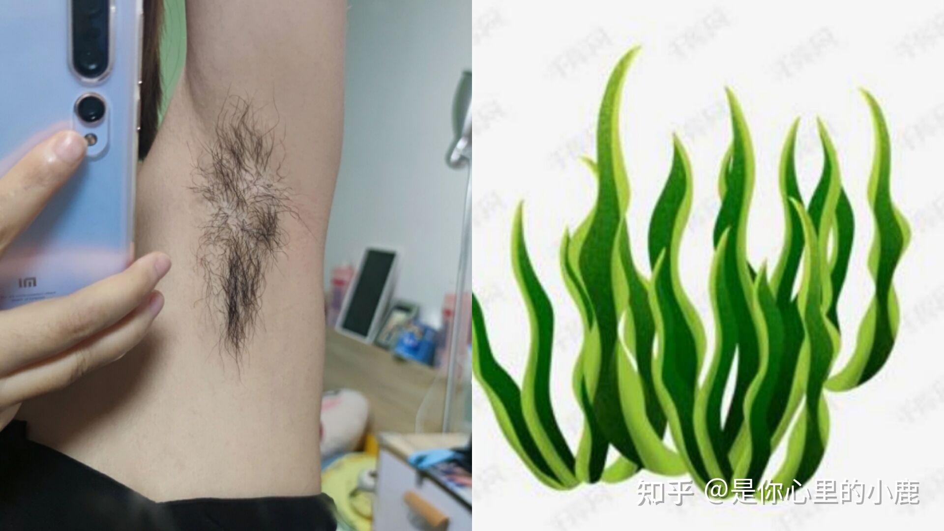 夏季穿吊带裙女生脱腋毛问题怎么解决