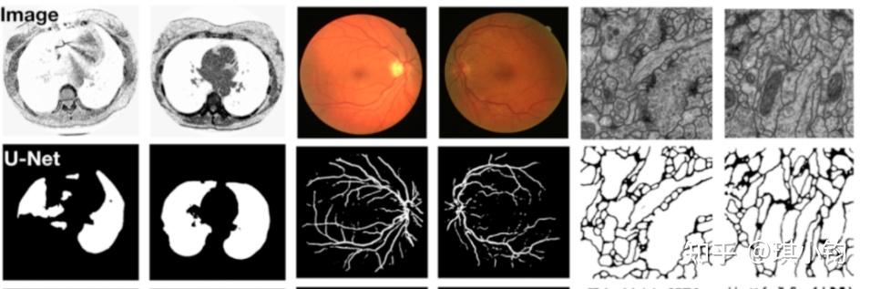 U Net ：convolutional Networks For Biomedical Image Segmentation 论文详解 知乎