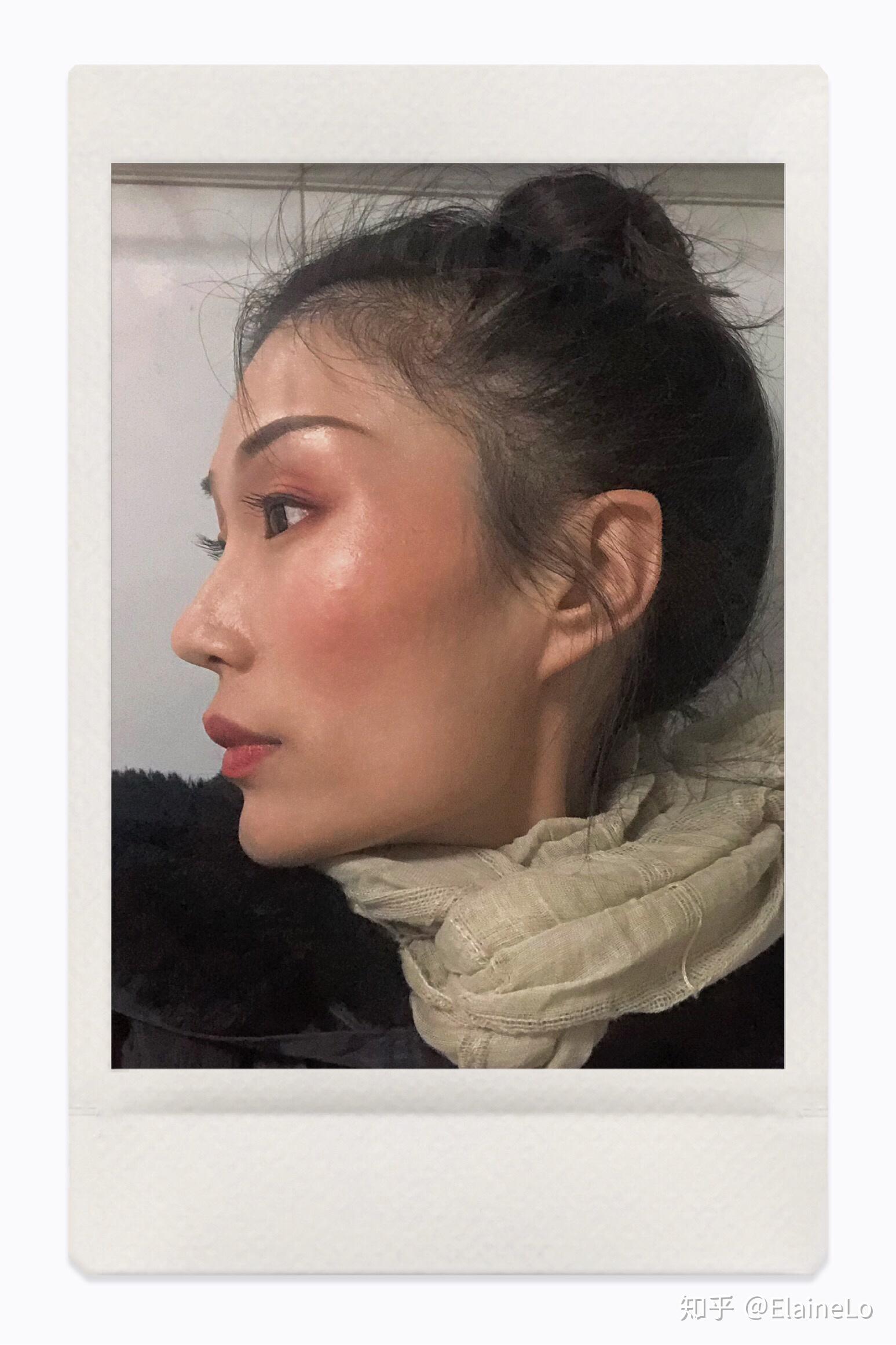 女孩子颧骨低才好看吗?