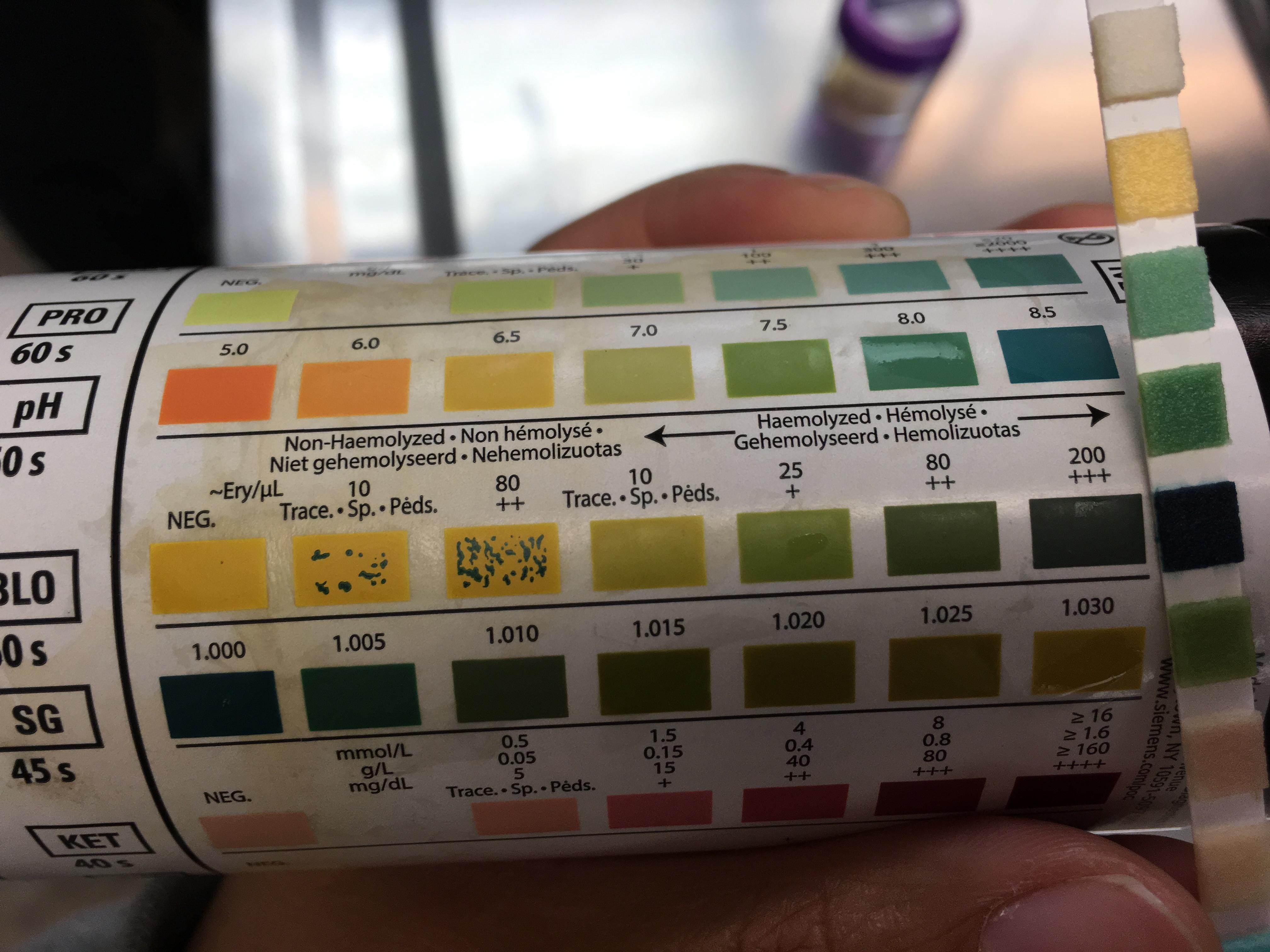 把试纸浸在尿样里,根据不同的检查项目等待30秒到1分钟后,对照试纸的