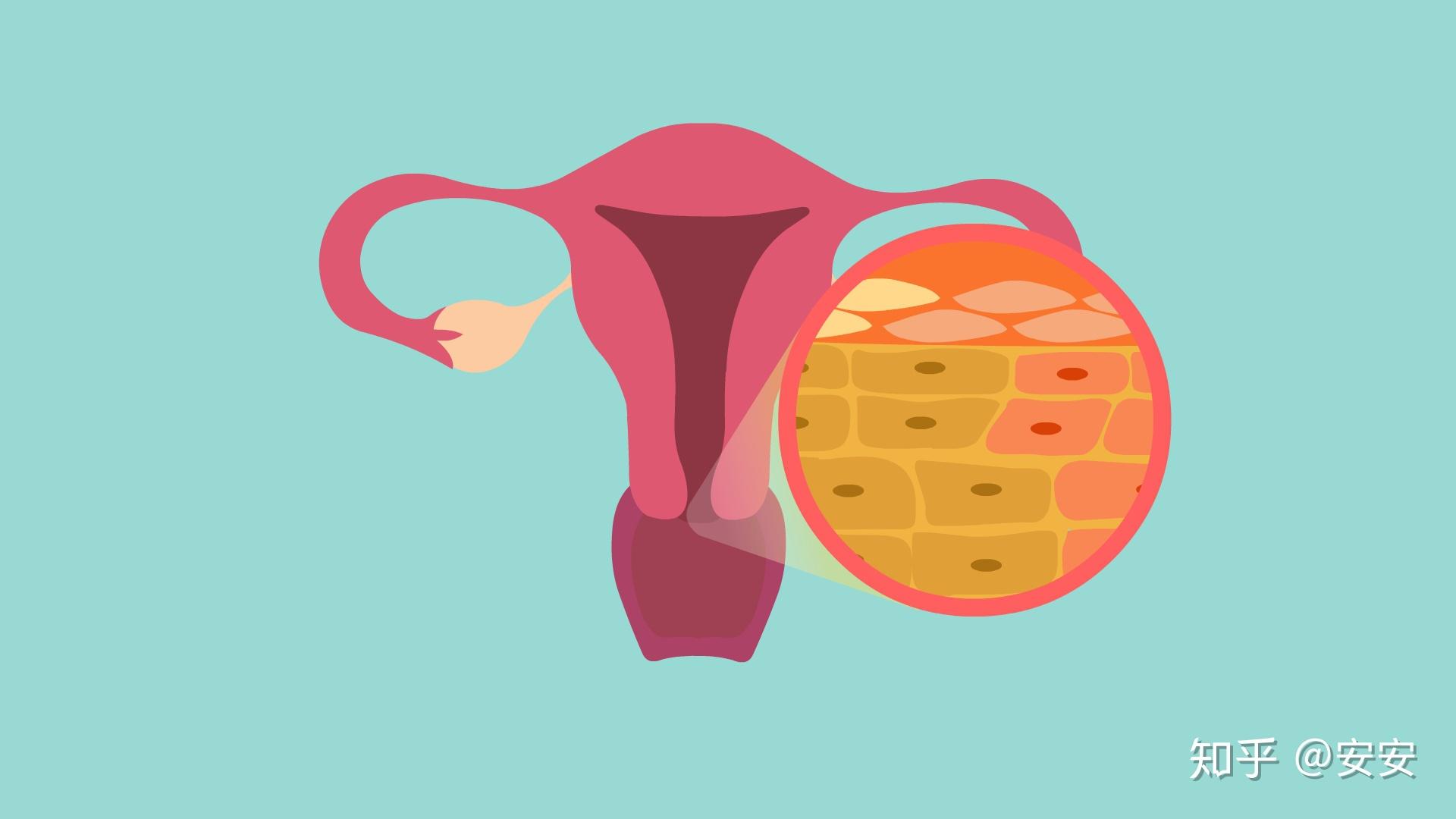 图解这五类女性, 最容易发生宫外孕!|宫外孕|输卵管|女性_新浪新闻