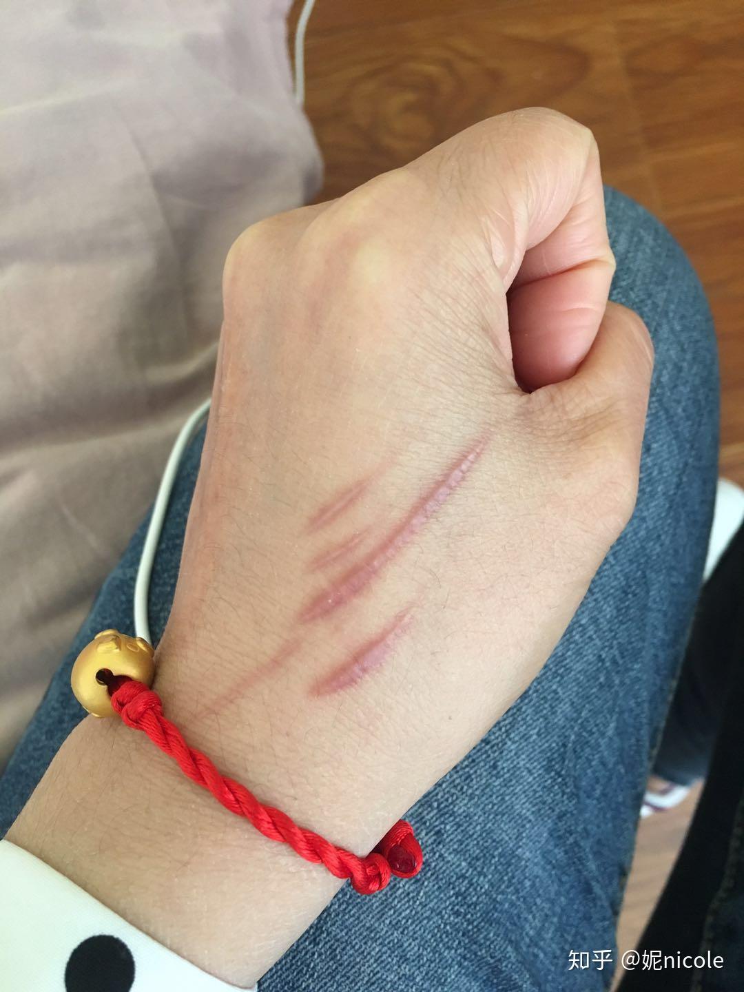 淡化疤痕祛疤膏