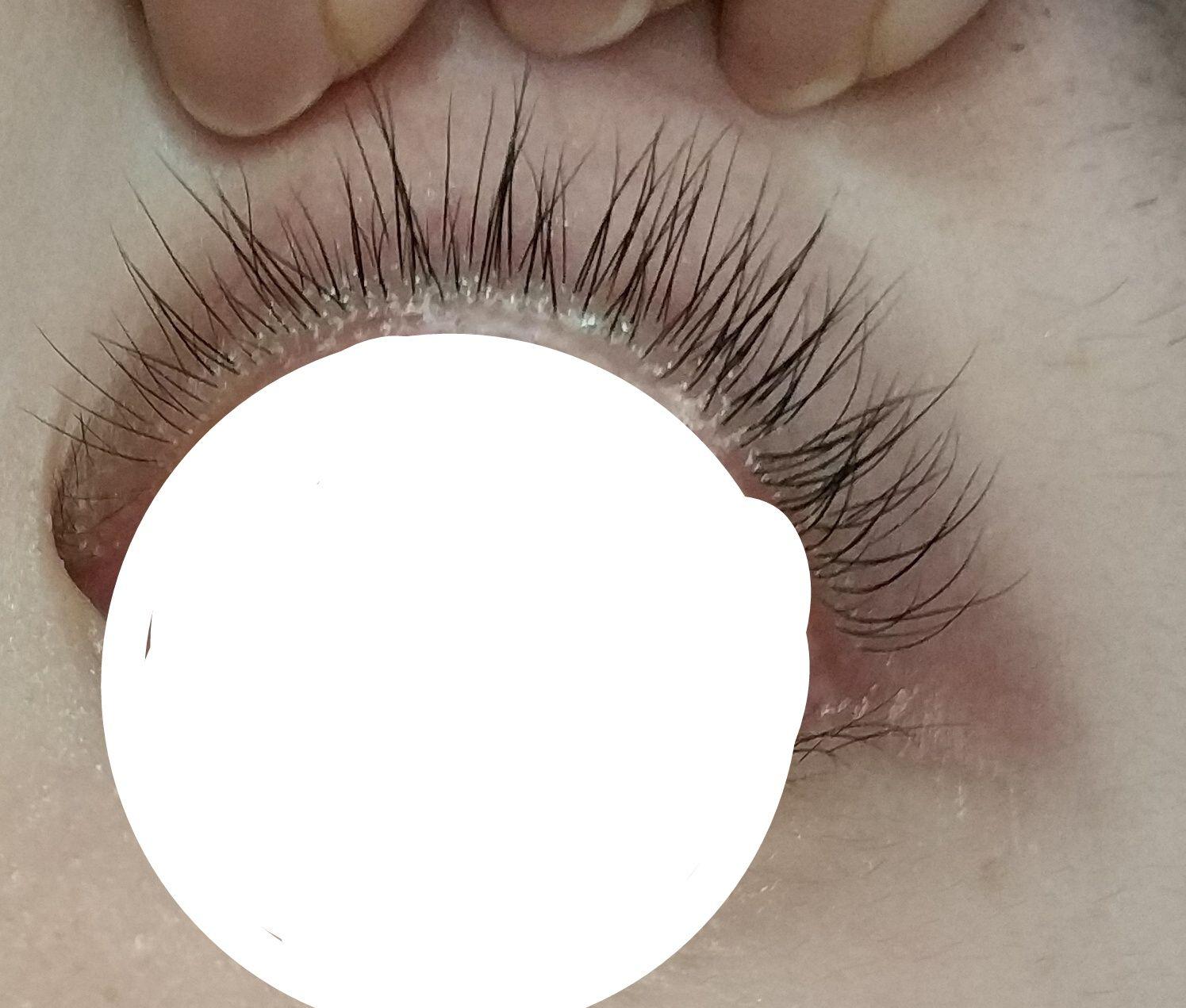 维生素e真的能使睫毛变长么