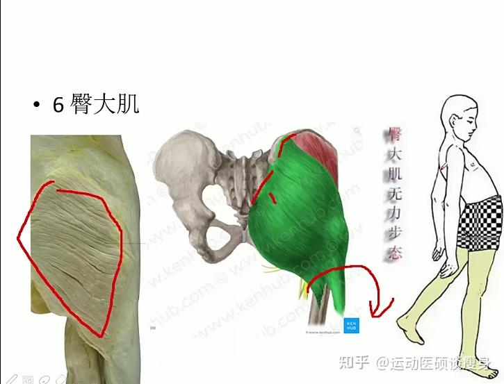 臀大肌:附著在髂嵴的後部,骶骨,骶結節韌帶,往外附著在股骨後方的臀肌