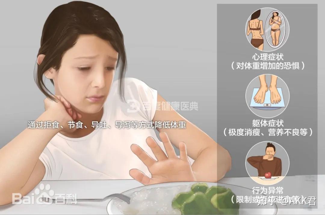 Nature子刊揭示肠菌异常引发神经性厌食症?厌食症缺乏6种丁酸生产菌包括AKK菌,可在食欲调节中起重要作用! - 知乎