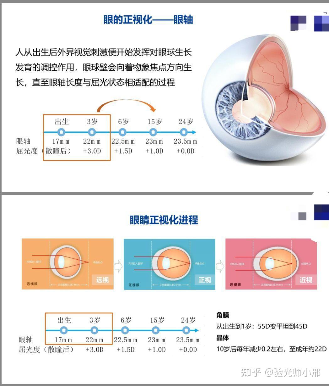 蔡司成长乐镜片原理图片