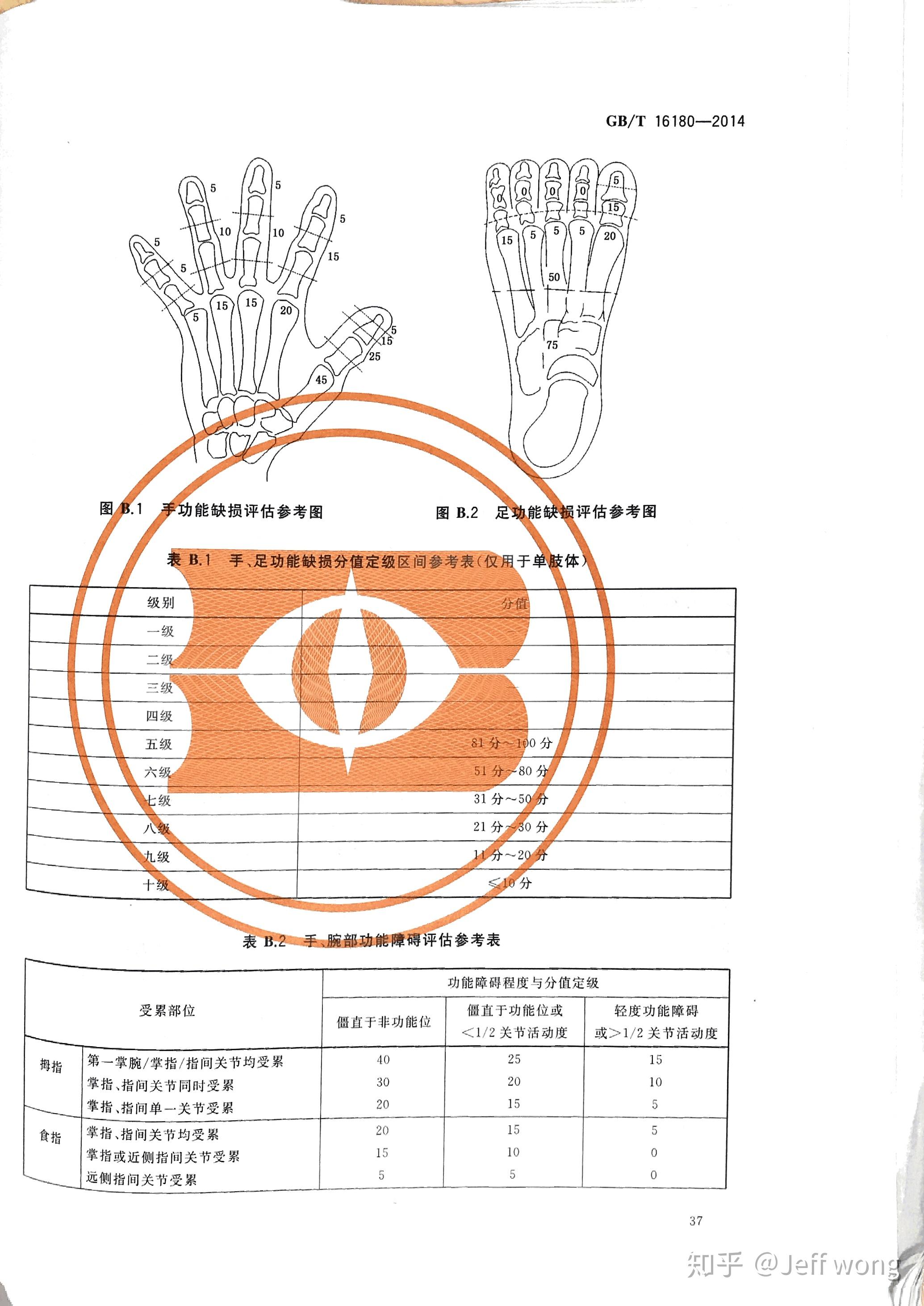 怎样才算手指功能丧失图片