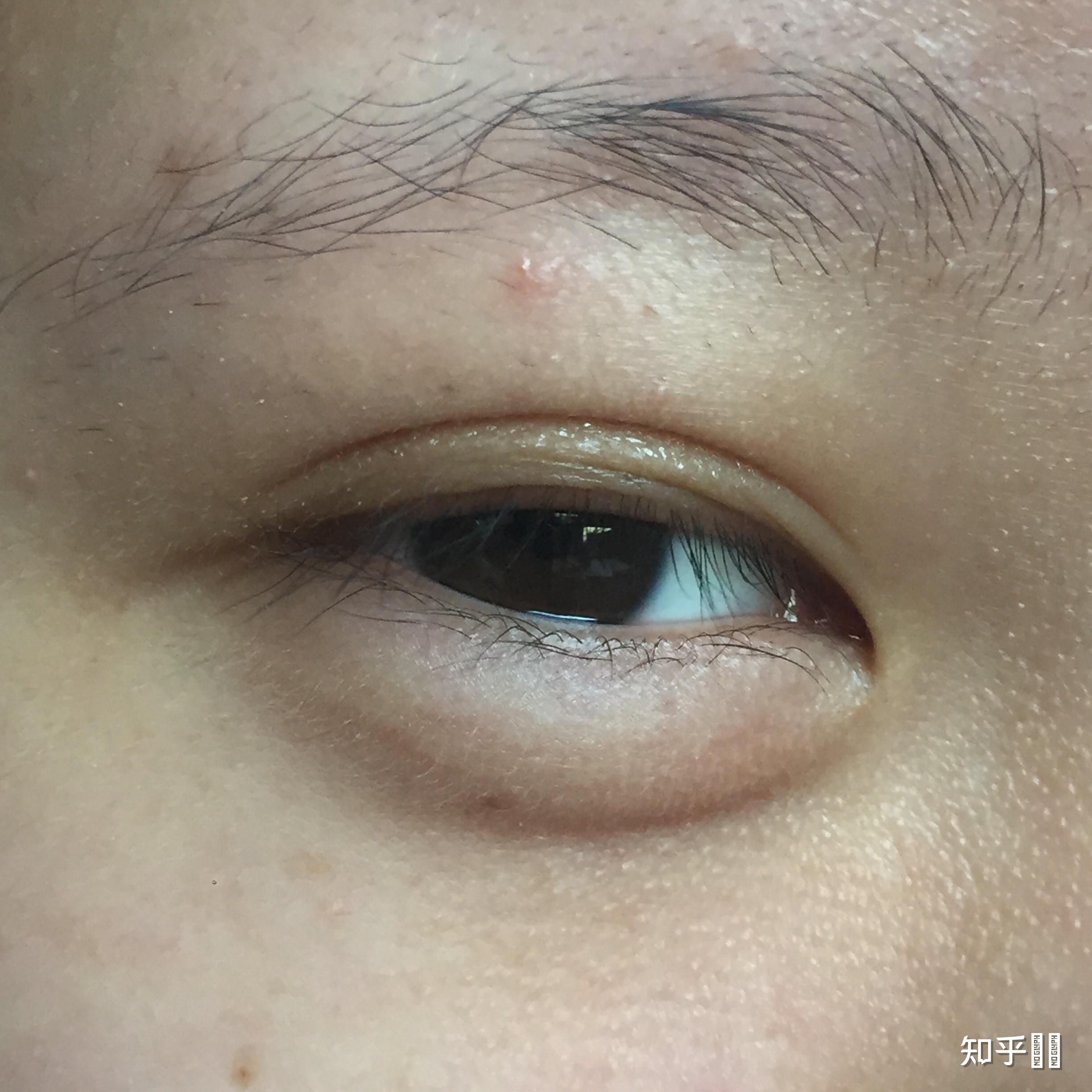 卧蚕比眼睛大是怎样一种体验? - 知乎