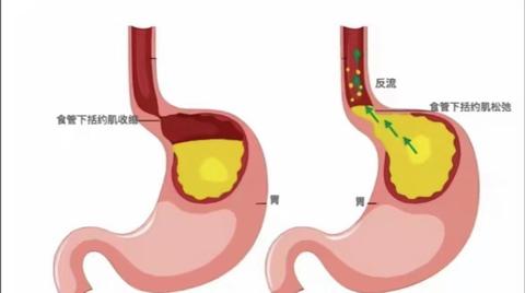 在校大学生,运营小白,梦想开餐厅gezelligheid吃什么食物可以保护胃