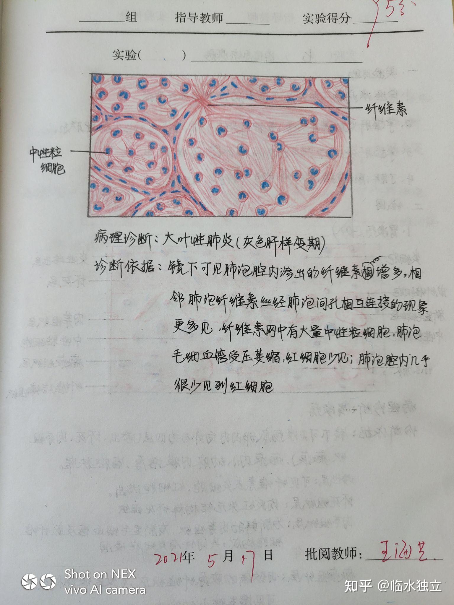 甲状腺红蓝铅笔绘图图片