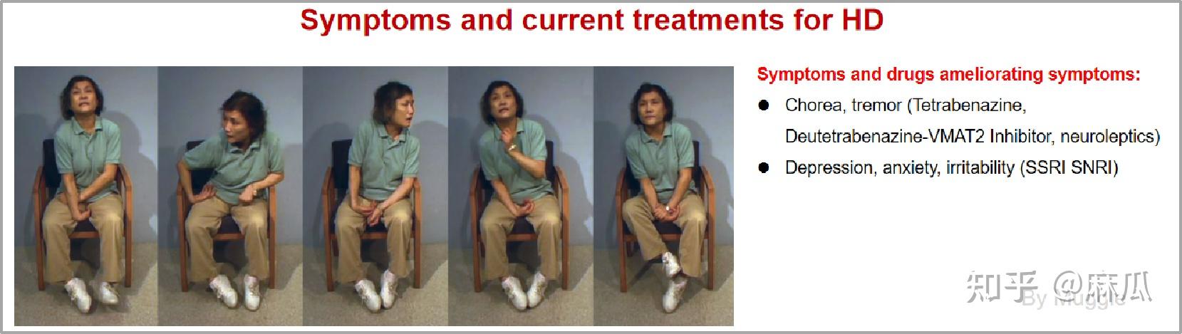 什么是亨廷顿舞蹈症它的病因和症状表现是什么