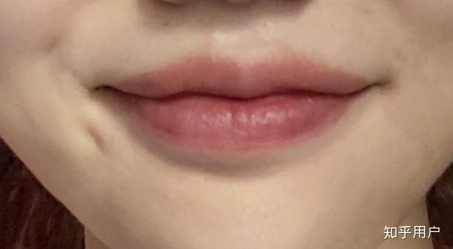 嘴角下有个窝不是梨涡是什么