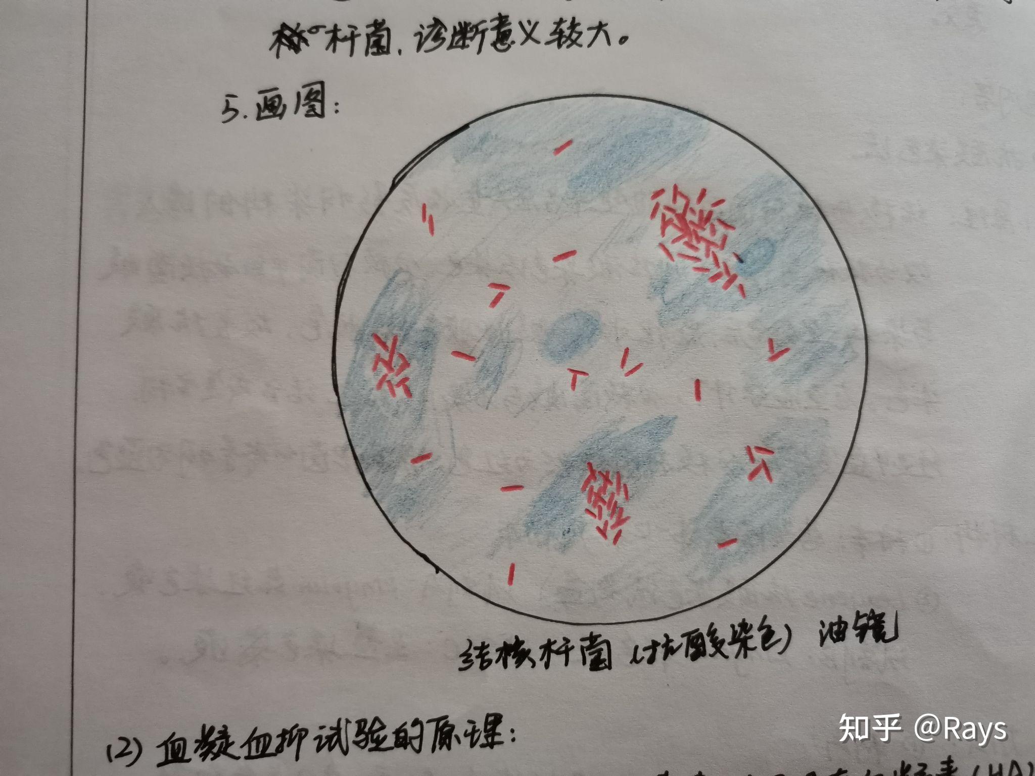 抗酸染色绘图图片
