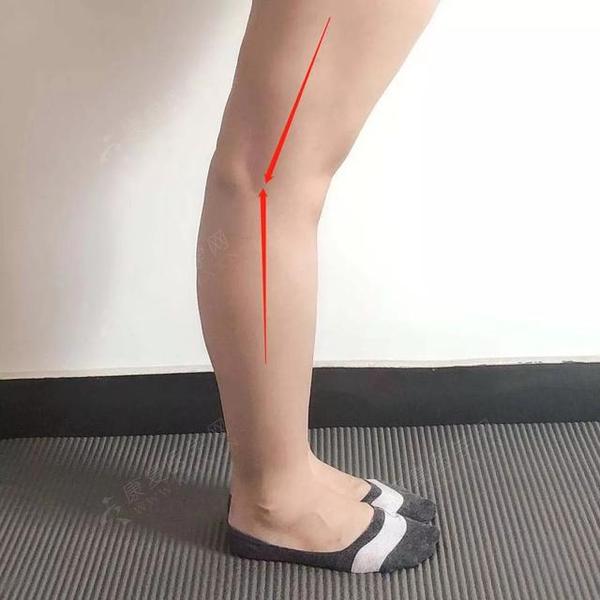 6组动作科学矫正 膝超伸 1分钟测出你的膝关节是否健康 知乎