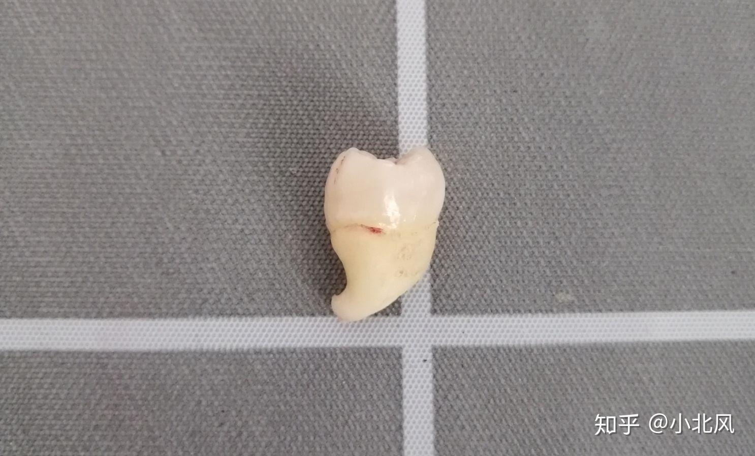 图4-82 上下牙弓牙尖咬合时右侧唇颊面观-口腔颌面及颈部临床解剖学-医学