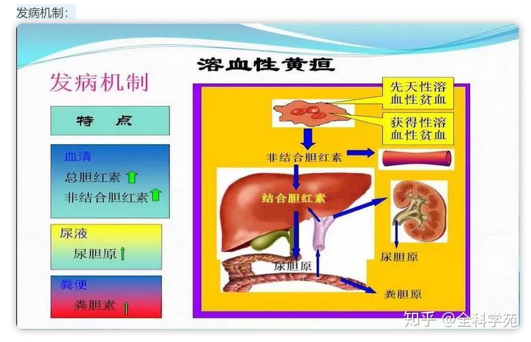 从症状谈疾病系列——黄疸 - 知乎