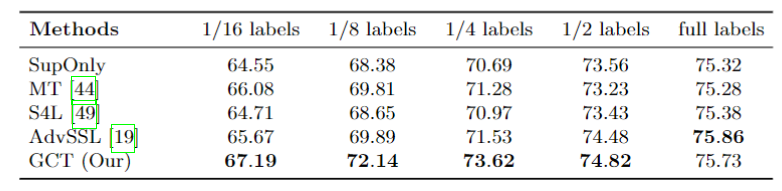 Guided Collaborative Training for Pixel-wise Semi-Supervised Learning - 知乎