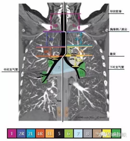 今日分享纵隔淋巴结分区图谱