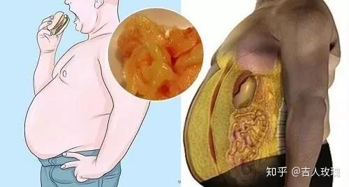 4招剷除內臟脂肪 減肥要減的是體脂 教你自我檢測內臟脂肪