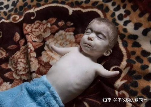 日本核污水排到海里,未来会出现《x战警》里的变种人吗? - 知乎