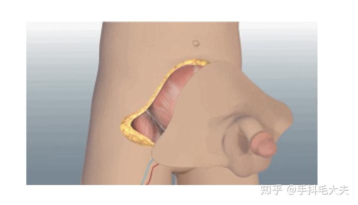 现代医学中最亮眼的手术是什么? 6 v2 544b503c1831bcccde7ae378ad37cca6 720w