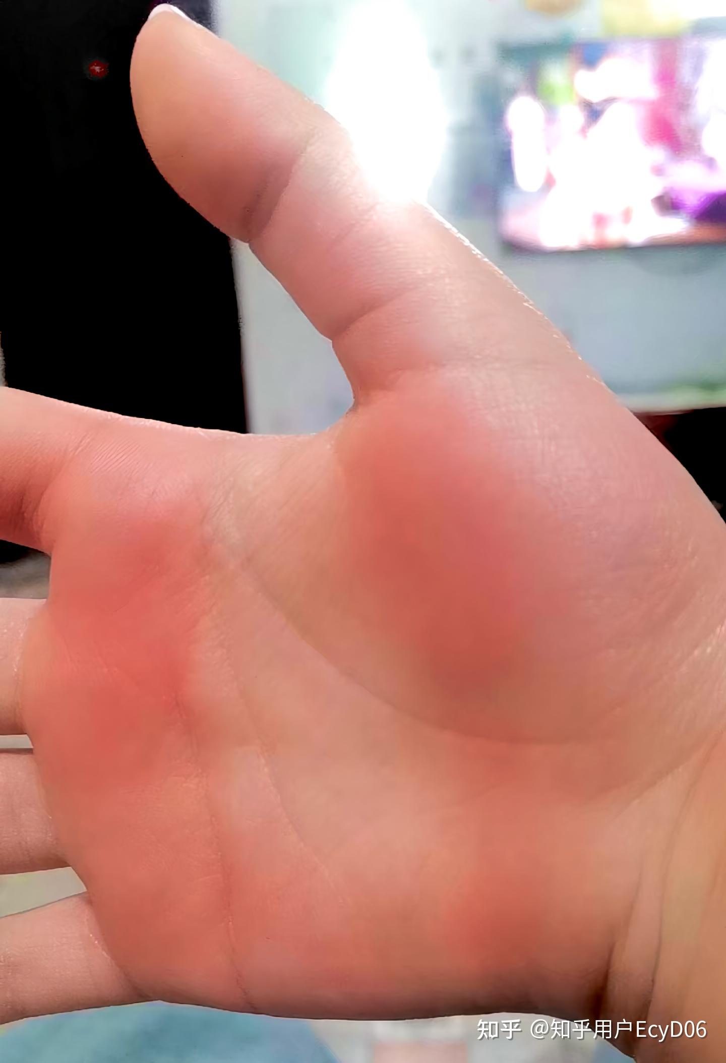 被老师用戒尺打手心是怎样一种体验