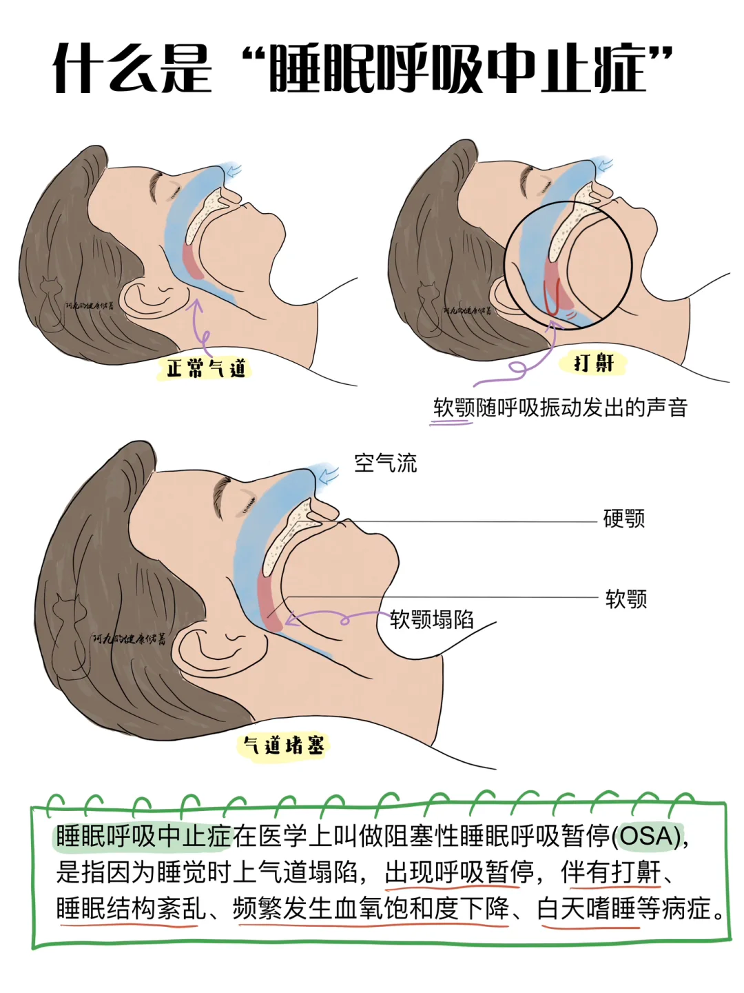 睡觉打呼噜有哪些危害?如何治疗打呼噜?