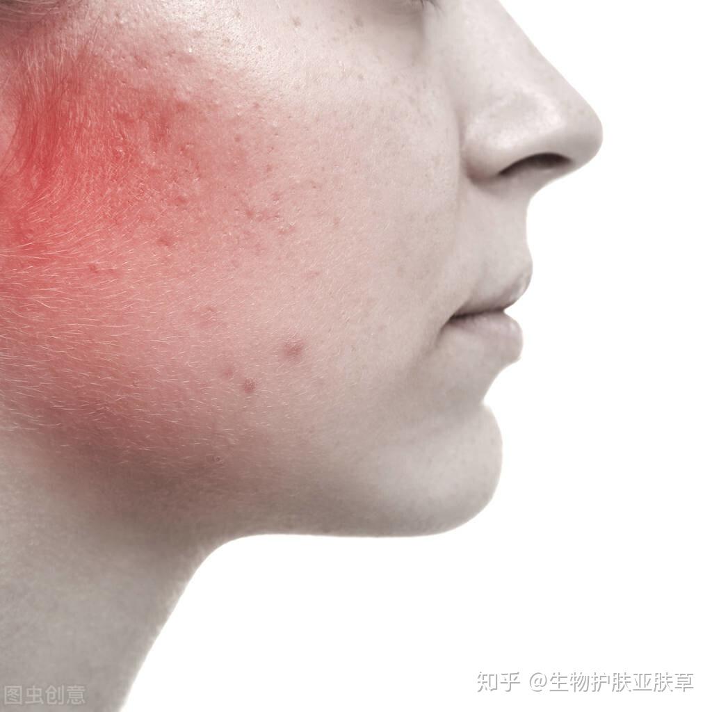 痒这是一种很正常的戒断现象,这样正说明戒断在产生效果.