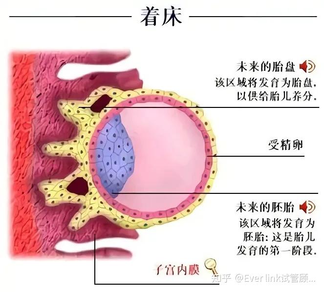 胚胎着床是一个复杂的过程,包括粘着,溶解,侵入3个阶段.