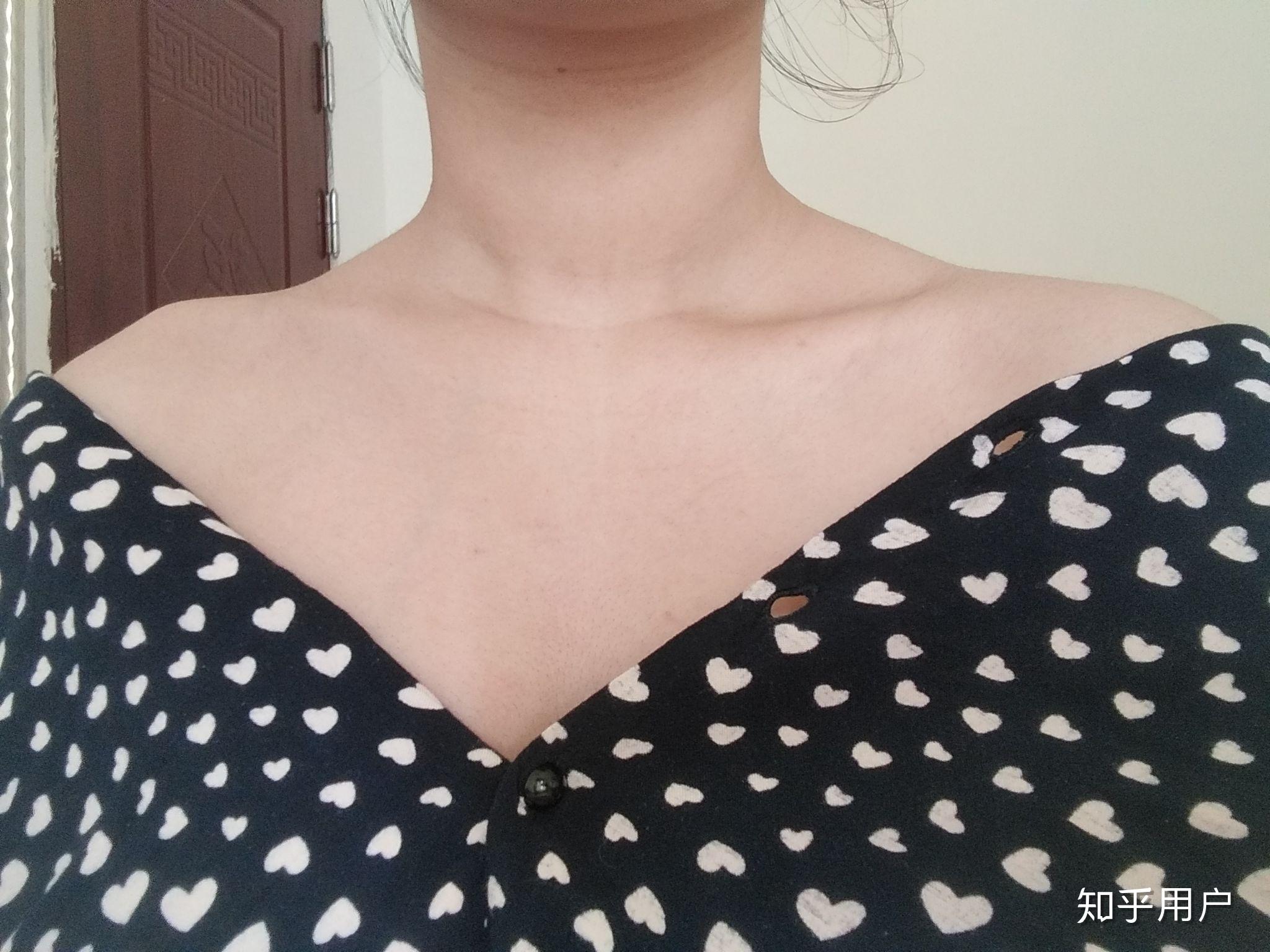 怎么去掉脖子上一圈一圈的肉? - 知乎