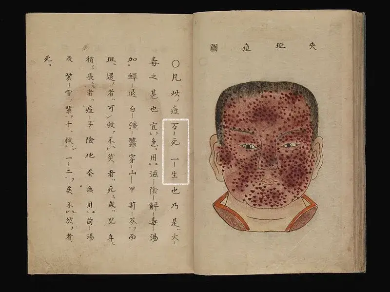 天花带来的罪恶屠杀