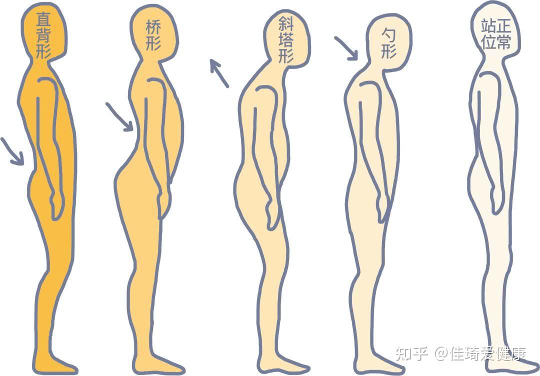 4,不良的站姿只要高跟鞋超过三厘米就会改变负重力线,骨盆会前倾,腰部
