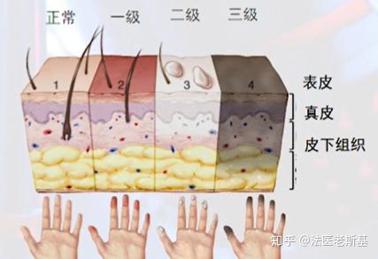 冻死的过程 - 知乎