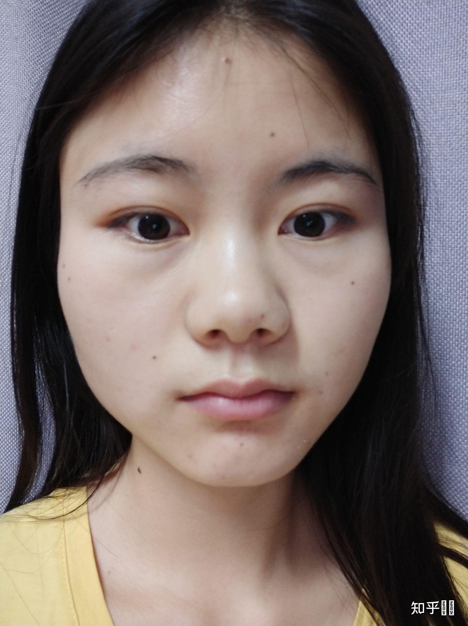 塌鼻梁女生一定不好看吗