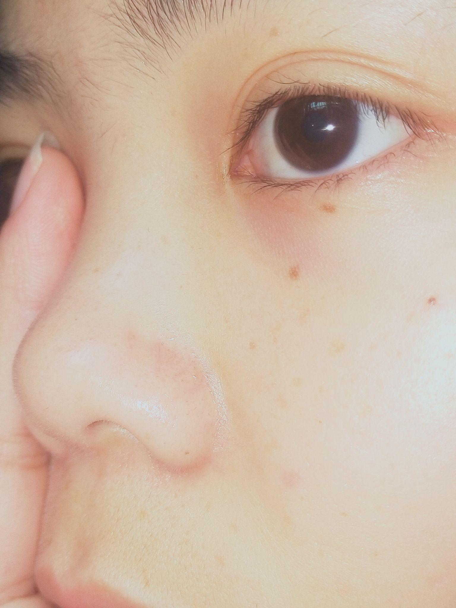 最后来几张全脸吧,我的鼻子是真的塌呀,希望姐妹们看看然后欢迎回答