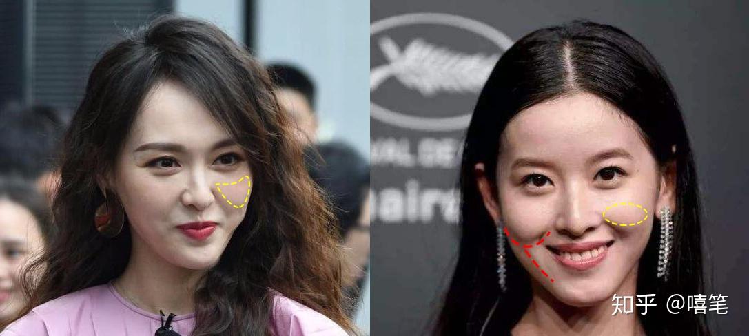 苹果肌太大了该如何是好