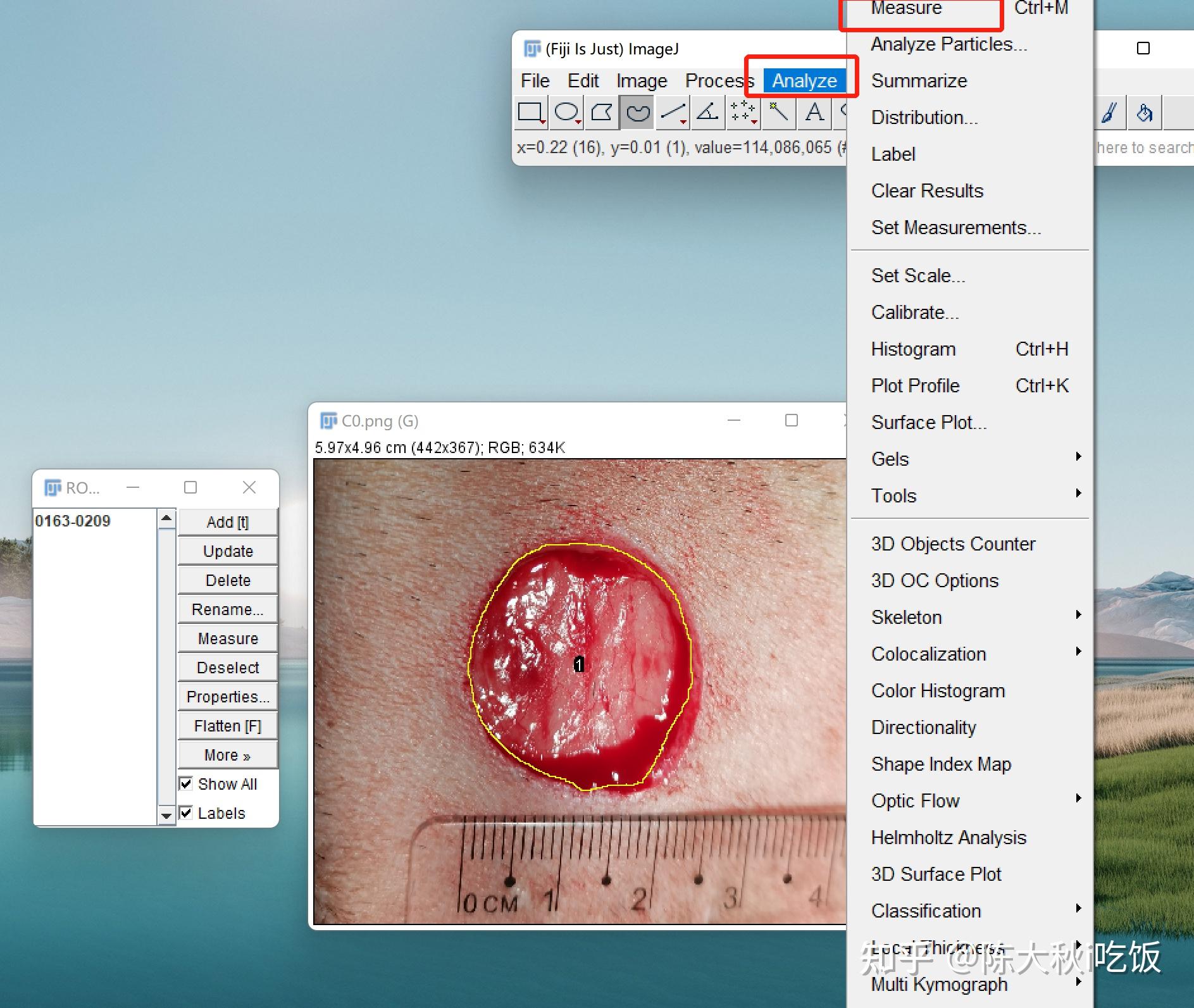 如何使用image J 测量皮肤伤口面积 知乎