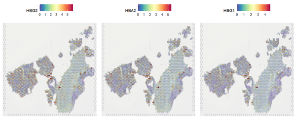 空间转录组|Load10X_Spatial函数修改适配多形式数据+ 空转标准流程- 知乎