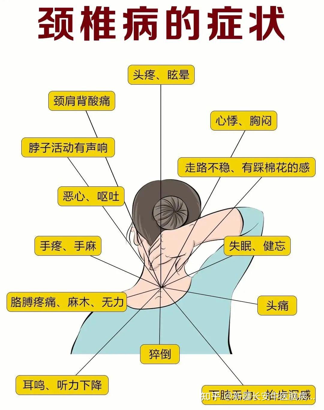 手脚发麻是怎么回事,该挂哪个科? - 知乎