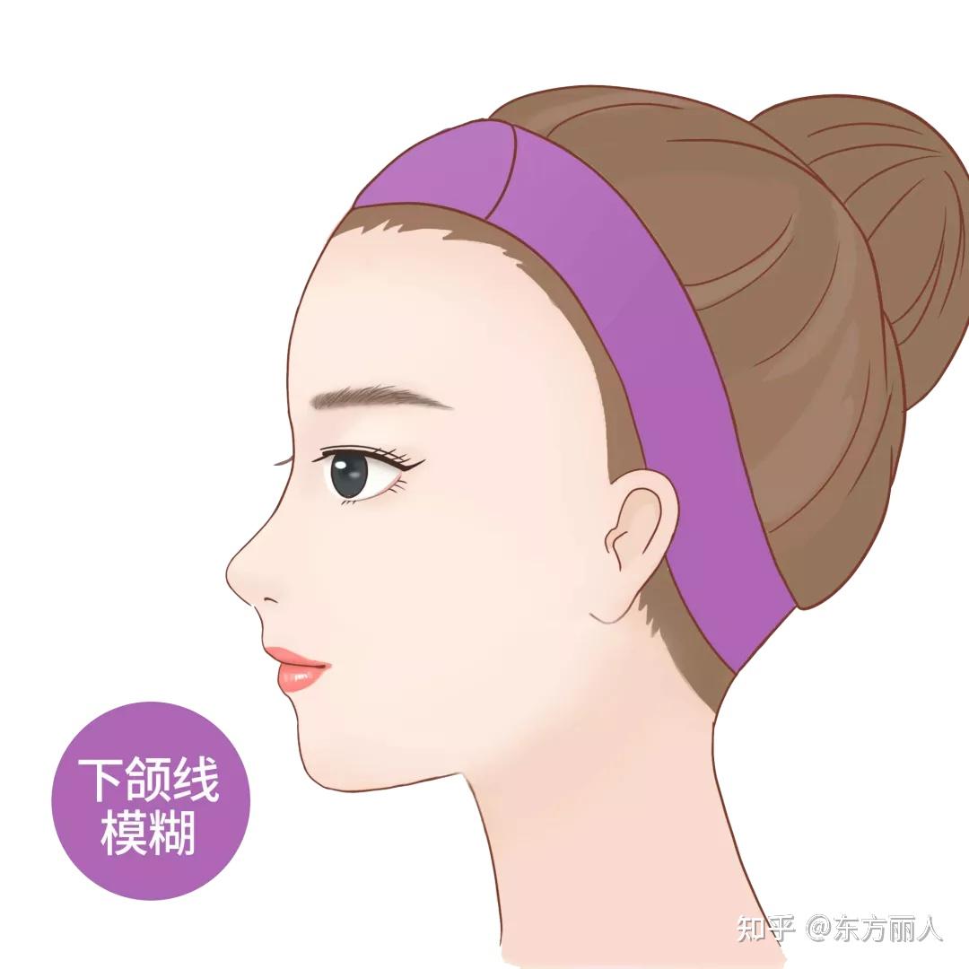 下颌缘不清晰的成因:整体面部松垂:整体面部松弛老化,无法抵抗地吸引