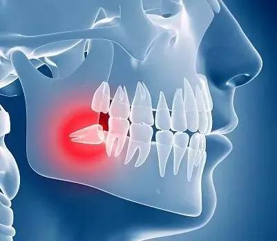 v2-55712dbcf4e9a2d06ace0d51afa4d475_1440w.jpg?source=172ae18b