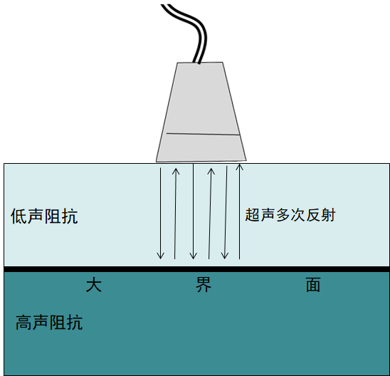 再来个图就比较明白了混响伪像容易发生在两侧声阻抗差异较大的大界面