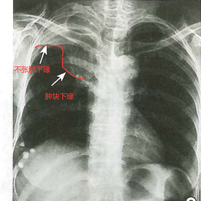 反s征绘图图片