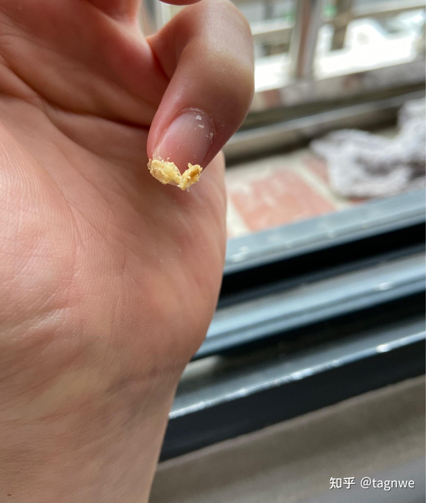 掏出一块超大耳屎,是种什么体验? - 知乎