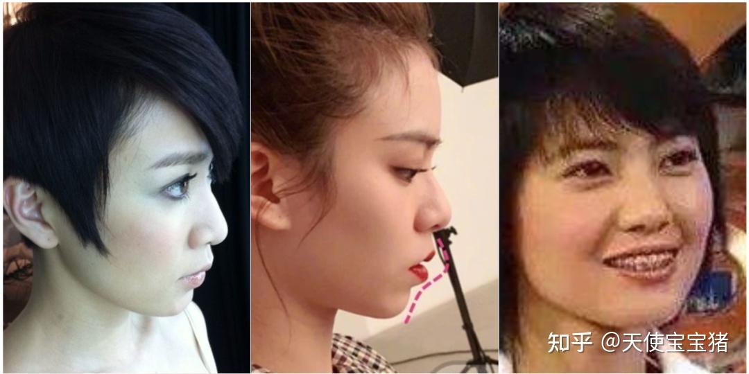 一,凸嘴发病率非常高,但未被重视