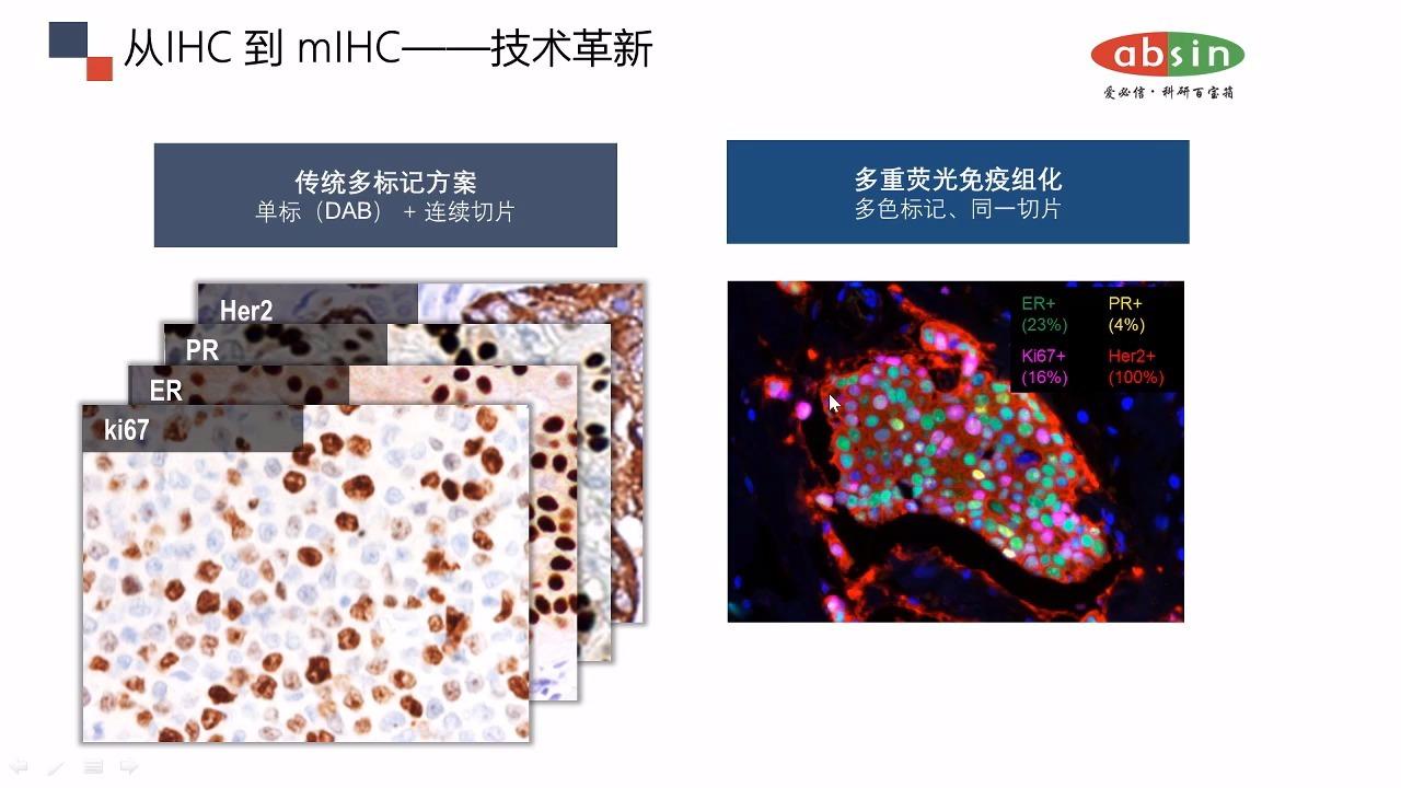 多重荧光免疫组化技术(mihc)