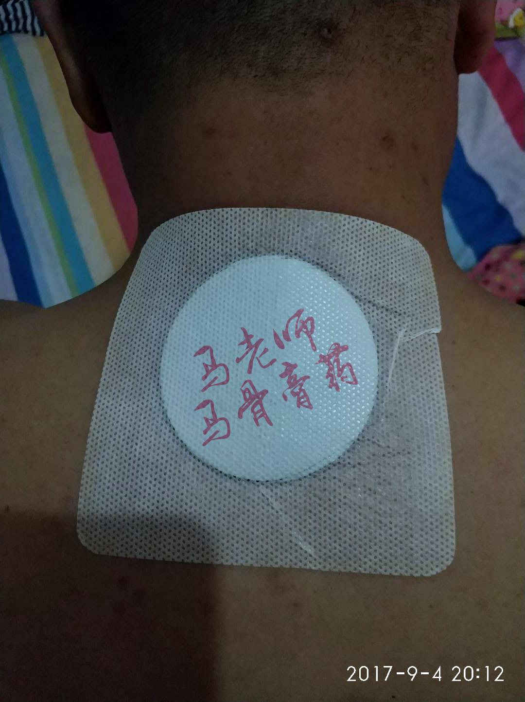 颈椎病有什么好的膏药