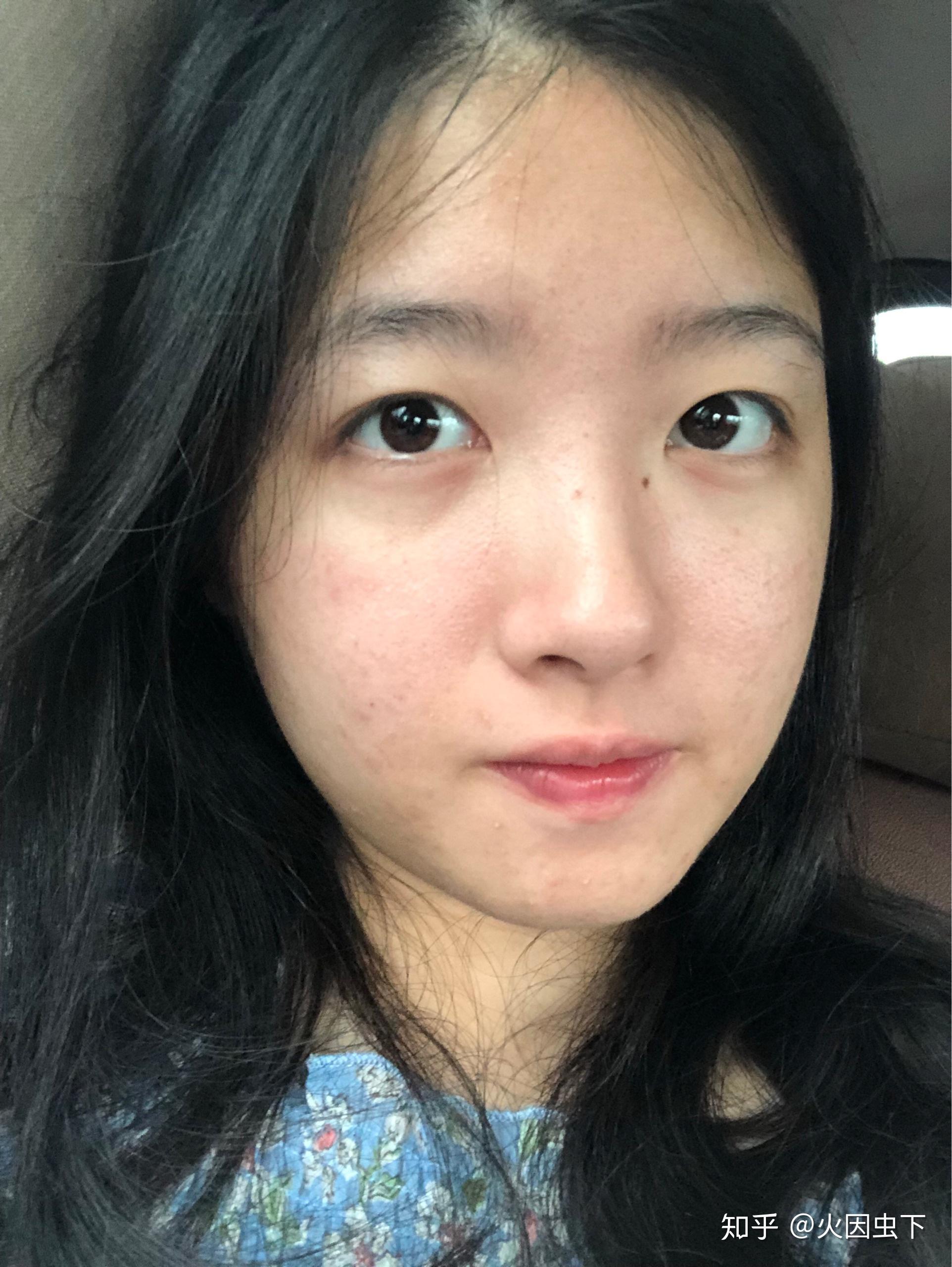 五官好看皮肤差是种怎样的体验