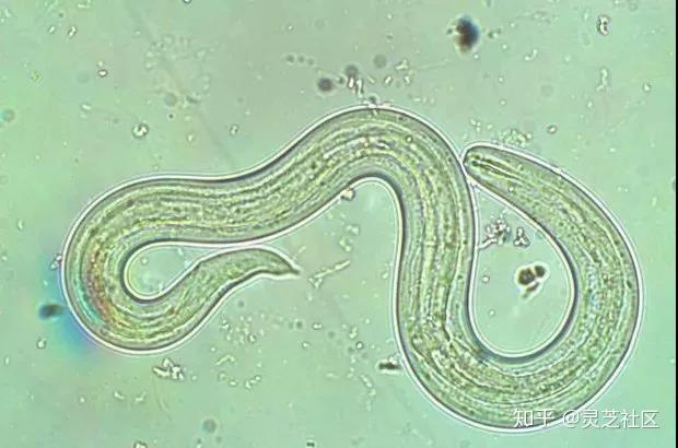 是住血线虫属(angiostrongylus)的一个物种,鼠肺线虫是一种寄生线虫